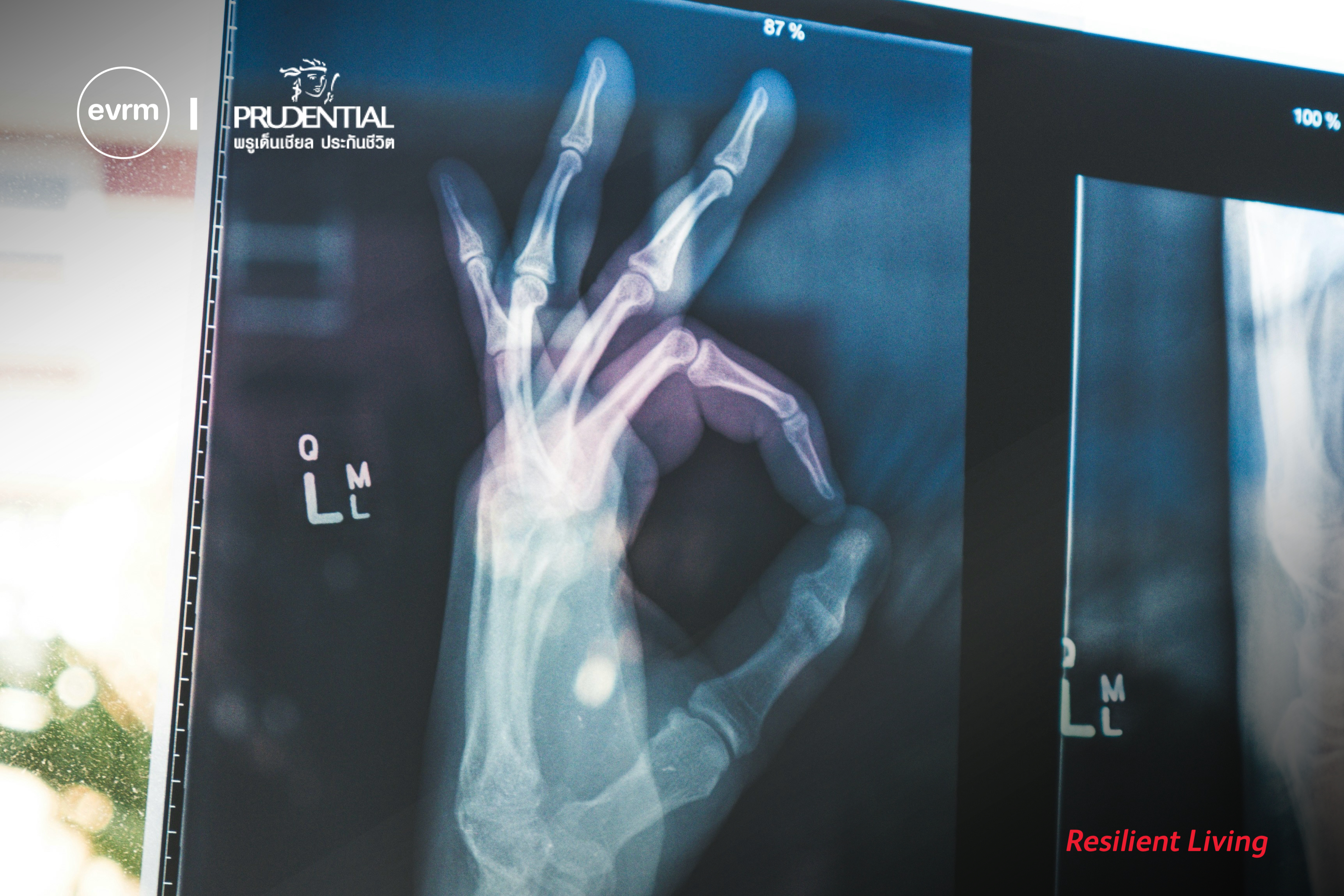 แม้อากาศจะเปลี่ยนไป แต่สุขภาพกายใจต้องไม่เปลี่ยนตาม